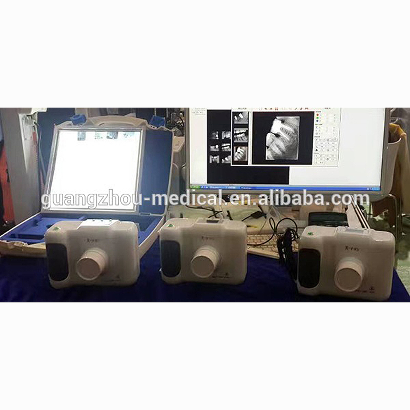 mecan mce jg01 high frequency portable dental x ray machine